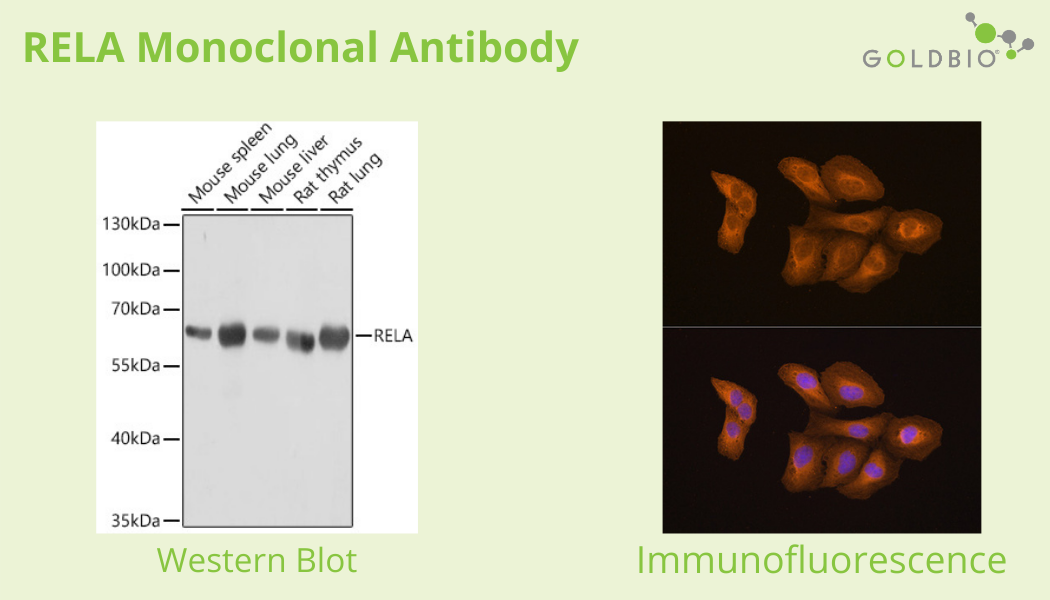 An Overview of Polyclonal and Monoclonal Antibodies Their Differences